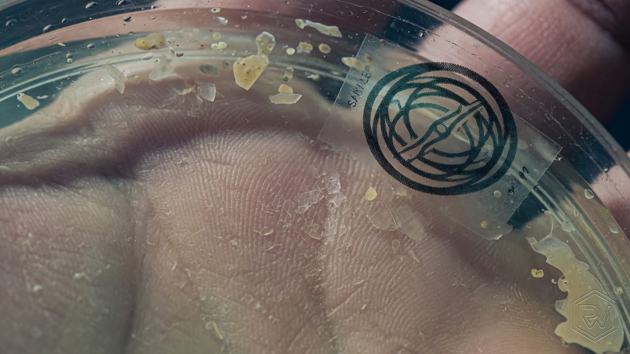 Outer Biosciences has raised about $23M to build a skin-assay licensing business