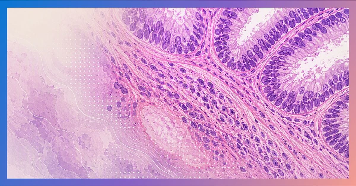 Microsoft spotlights Paige's year-old PRISM2 model trained on 2.3 million pathology slides